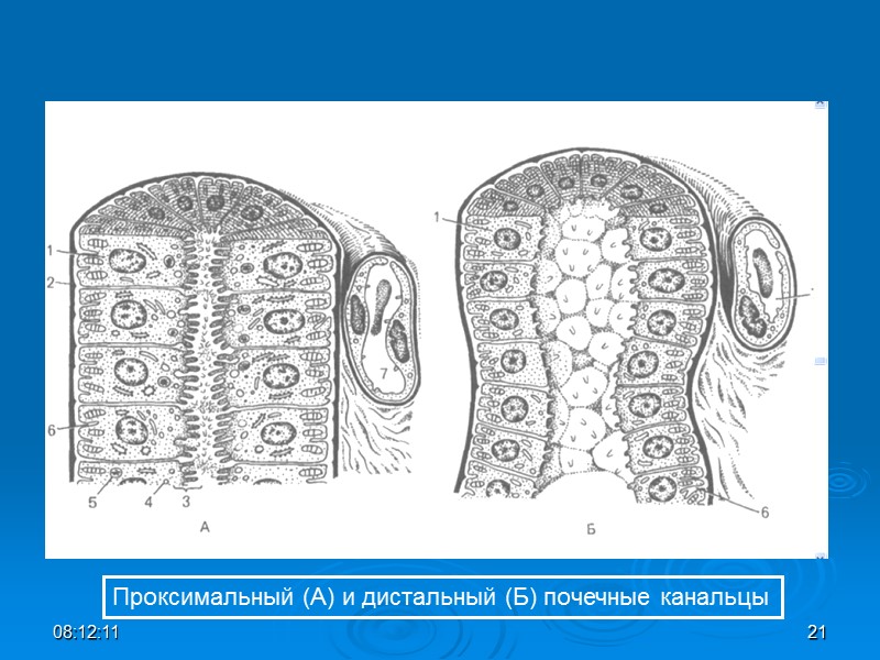 Проксимальный (А) и дистальный (Б) почечные канальцы 08:12:01 21